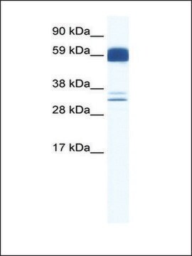 Anti-ZIC5 antibody produced in rabbit affinity isolated antibody