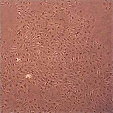 Porcine Pulmonary Artery Endothelial Cells: PPAEC (Cryovial)