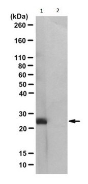 Anticorps anti-N3-phosphohistidine (3-pHis), clone SC56-2 clone SC56-2, from rabbit