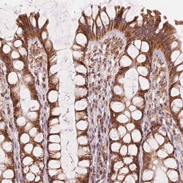 Anti-CLPB Prestige Antibodies&#174; Powered by Atlas Antibodies, affinity isolated antibody, buffered aqueous glycerol solution