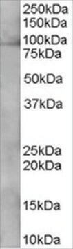 Anti-XAB2/HCNP antibody produced in goat affinity isolated antibody, buffered aqueous solution