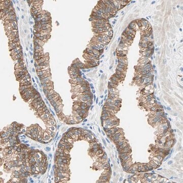 抗ATF6 ウサギ宿主抗体 Prestige Antibodies&#174; Powered by Atlas Antibodies, affinity isolated antibody, buffered aqueous glycerol solution