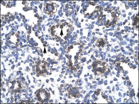 Anti-FOXA3 affinity isolated antibody