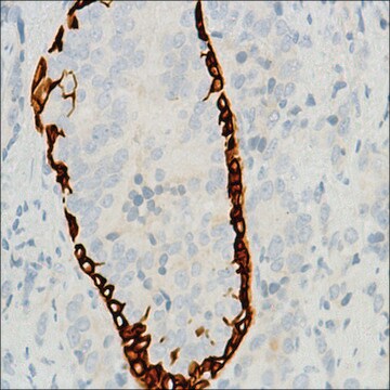 Anti-Keratin 6 antibody, Rabbit monoclonal recombinant, expressed in proprietary host, clone SP87, affinity isolated antibody