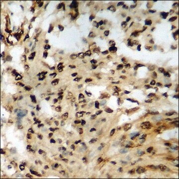 Anti-phospho-Retinoblastoma (pSer807) antibody produced in rabbit affinity isolated antibody