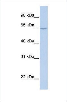 抗ARID5A抗体(ab1) ウサギ宿主抗体 affinity isolated antibody