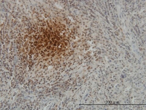 Monoclonal Anti-SFTPD, (C-terminal) antibody produced in mouse clone 2A10, purified immunoglobulin, buffered aqueous solution