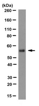 Anti-ATP-Synthase-Untereinheit-&#946;-Antikörper, Klon&nbsp;11/21-7-A8 clone 11/21-7-A8, from mouse