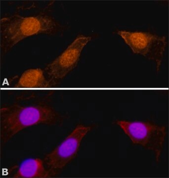 抗ミオシンI &#946;(核)抗体 ウサギ宿主抗体 affinity isolated antibody, buffered aqueous solution