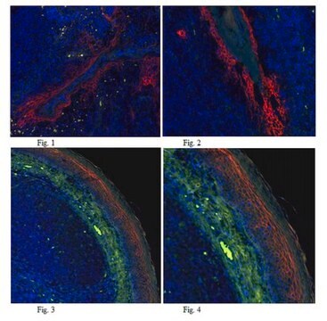 Anti-Desmoglein-1 Antibody, clone 32-2B clone 32-2B, from mouse