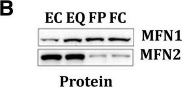 Anti-Mitofusin-2 (Mfn2) Antibody from rabbit, purified by affinity chromatography