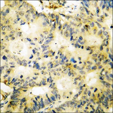 Anti-phospho-SYK (pTyr348) antibody produced in rabbit affinity isolated antibody