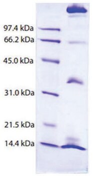 Chylomicrons from human plasma &#8805;95% (SDS-PAGE)