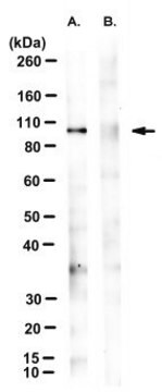 Anti-phospho-VCP (Ser784) Antibody, clone 3E4