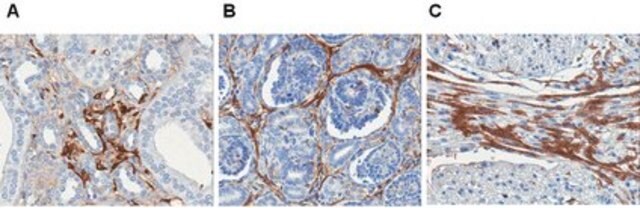 Anticuerpo anti-laminina-5, clon P3E4 clone P3E4, Chemicon&#174;, from mouse