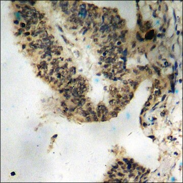 Anti-phospho-ATRIP (pSer68) antibody produced in rabbit affinity isolated antibody