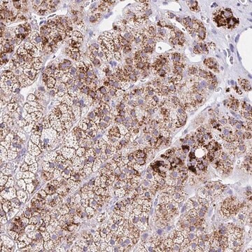 Anti-ANKRD9 antibody produced in rabbit Prestige Antibodies&#174; Powered by Atlas Antibodies, affinity isolated antibody, buffered aqueous glycerol solution