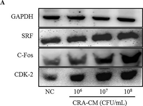 Anticuerpo anti-c-Fos Chemicon&#174;, from sheep