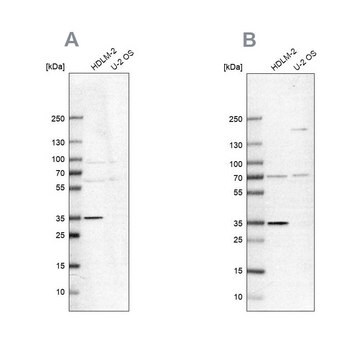 Anti-TTC19 antibody produced in rabbit Prestige Antibodies&#174; Powered by Atlas Antibodies, affinity isolated antibody, buffered aqueous glycerol solution