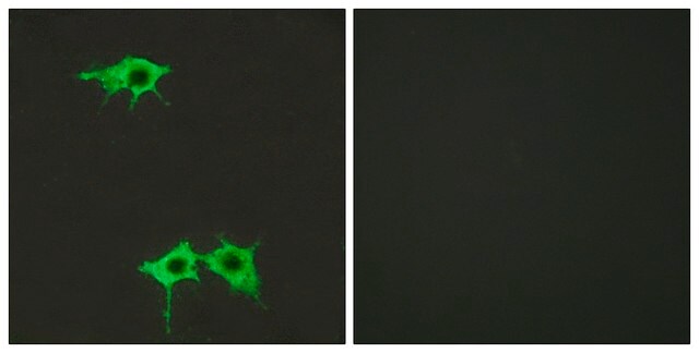 Anti-FZD4 antibody produced in rabbit affinity isolated antibody