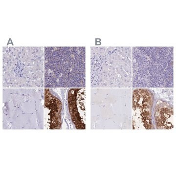 Anti-LZTFL1 antibody produced in rabbit Prestige Antibodies&#174; Powered by Atlas Antibodies, affinity isolated antibody, buffered aqueous glycerol solution