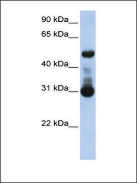 Anti-ACVRL1 antibody produced in rabbit affinity isolated antibody