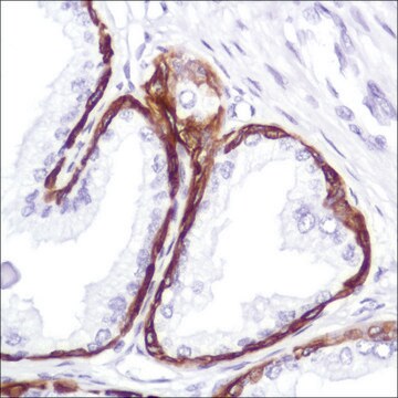 Anti-Keratin 5 antibody, Rabbit monoclonal clone SP178, recombinant, expressed in proprietary host, affinity isolated antibody