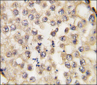 Anti-CCDC5 (N-term) antibody produced in rabbit saturated ammonium sulfate (SAS) precipitated, buffered aqueous solution