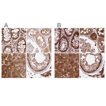 Anti-GBE1 antibody produced in rabbit Prestige Antibodies&#174; Powered by Atlas Antibodies, affinity isolated antibody, buffered aqueous glycerol solution