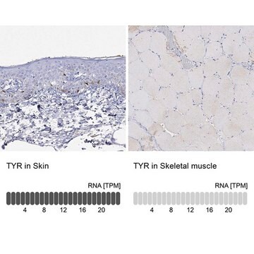 Anty-TYR Prestige Antibodies&#174; Powered by Atlas Antibodies, affinity isolated antibody, buffered aqueous glycerol solution