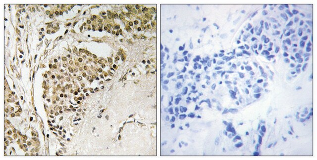 Anti-NOM1, C-Terminal antibody produced in rabbit affinity isolated antibody