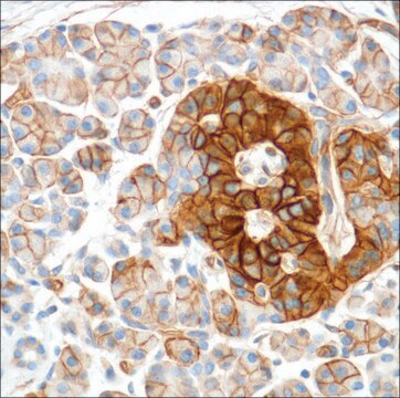 Anti-HENT1 antibody, Rabbit monoclonal recombinant, expressed in proprietary host, clone SP120, affinity isolated antibody