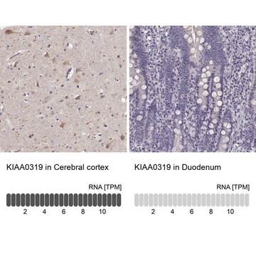 Anti-KIAA0319 antibody produced in rabbit Prestige Antibodies&#174; Powered by Atlas Antibodies, affinity isolated antibody, buffered aqueous glycerol solution