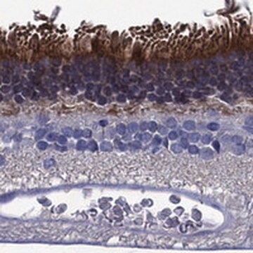 Anti-FSCN2 antibody produced in rabbit Prestige Antibodies&#174; Powered by Atlas Antibodies, affinity isolated antibody, buffered aqueous glycerol solution