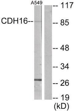 Anti-CDH16 antibody produced in rabbit affinity isolated antibody