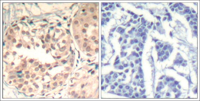 Anti-phospho-CDK6 (pTyr13) antibody produced in rabbit affinity isolated antibody