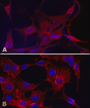 Anti-Superoxide Dismutase (MnSOD) (DD-17) antibody produced in rabbit affinity isolated antibody, buffered aqueous solution