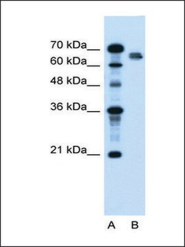 抗NR5A2抗体 ウサギ宿主抗体 IgG fraction of antiserum