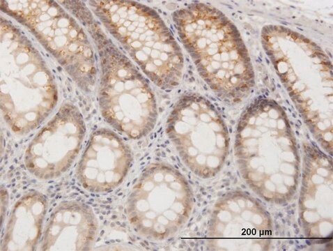 Anti-GOT1 antibody produced in rabbit purified immunoglobulin, buffered aqueous solution