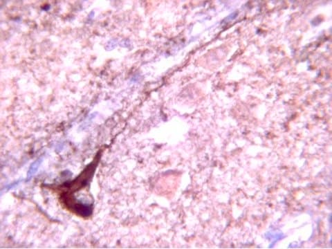 Anti-Tau-Phosphothreonin-231-Antikörper Chemicon&#174;, from rabbit