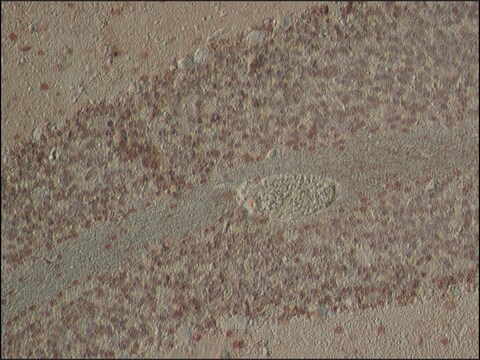 Anti-SOX11 (C-terminal) antibody produced in rabbit IgG fraction of antiserum