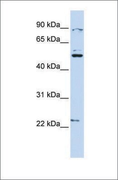 Anti-XK (ab2) antibody produced in rabbit affinity isolated antibody