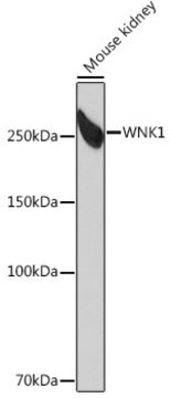 Anti-WNK1 Antibody, clone 6C5S6, Rabbit Monoclonal