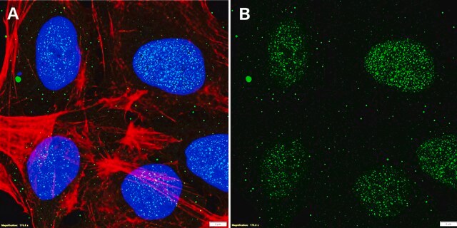 Anti-TRF2 Antibody, clone 1N14 ZooMAb&#174; Rabbit Monoclonal recombinant, expressed in HEK 293 cells