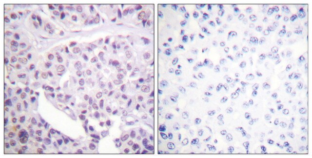 Anti-p53, antibody produced in rabbit affinity isolated antibody