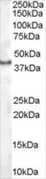 Anti-CDX2 antibody produced in goat affinity isolated antibody, buffered aqueous solution