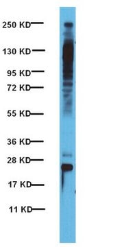 Anti-Phosphothreonine-Proline Antibody from rabbit, purified by affinity chromatography