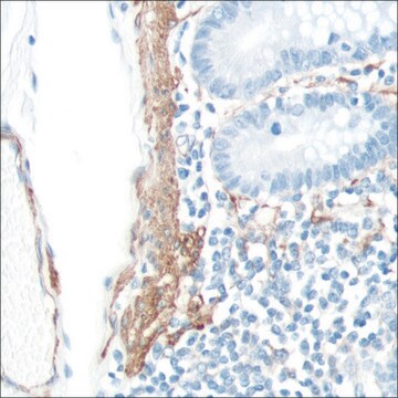 抗- SMA 抗体，兔单克隆 clone SP171, recombinant, expressed in proprietary host, affinity isolated antibody