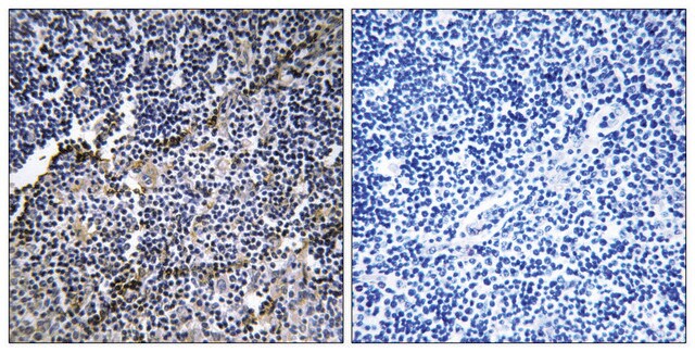 Anti-Collagen XIX &#945;1 antibody produced in rabbit affinity isolated antibody