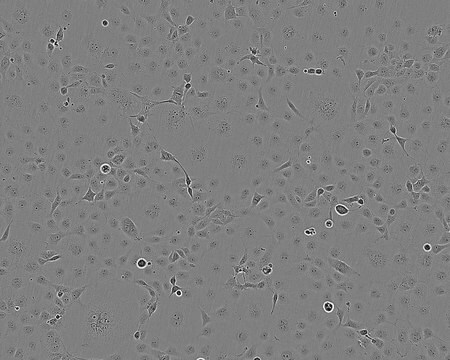 COS-7 Cell Line NOTE: Both the cell line and DNA from the cell line may be available for this product. Please choose -1VL or VIAL for cells, or -DNA-5UG for DNA, 87021302, African green monkey kidney, Fibroblast